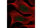 Immunofluorescent staining of human cell line U-2 OS shows localization to nucleoplasm.