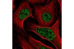 Immunofluorescent staining of human cell line U-2 OS shows localization to nuclear speckles.