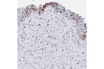 Immunohistochemical staining of human urinary bladder shows strong nuclear positivity in urothelial cells.
