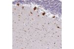 Immunohistochemical staining of human cerebellum shows strong cytoplasmic positivity in Purkinje cells.