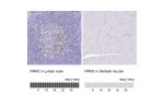 Immunohistochemistry analysis in human lymph node and skeletal muscle tissues using HPA056994 antibody. Corresponding RRM2 RNA-seq data are presented for the same tissues.