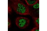 Immunofluorescent staining of human cell line A-431 shows localization to nucleoplasm.