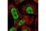 Immunofluorescent staining of human cell line U-251 MG shows localization to nucleoplasm & cytosol.