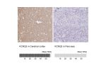 Immunohistochemistry analysis in human cerebral cortex and pancreas tissues using Anti-KCNQ2 antibody. Corresponding KCNQ2 RNA-seq data are presented for the same tissues.