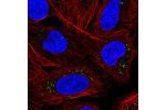 Immunofluorescent staining of human cell line U-2 OS shows localization to vesicles.