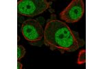 Immunofluorescent staining of human cell line PC-3 shows localization to nucleoplasm.