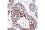Immunohistochemical staining of human testis shows moderate nuclear and cytoplasmic positivity in cells in seminiferous ducts.