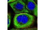 Immunofluorescent staining of human cell line A-431 shows localization to nuclear membrane, cytosol & vesicles.