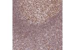 Immunohistochemical staining of human tonsil shows nuclear positivity in germinal center and non-germinal center cells.