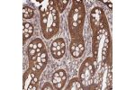 Immunohistochemical staining of human Rectum shows moderate membranous and cytoplasmic positivity in glandular cells.