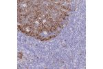 Immunohistochemical staining of human tonsil shows cytoplasmic positivity in germinal center.