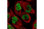 Immunofluorescent staining of human cell line U-251 MG shows localization to nucleoplasm.