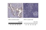 Immunohistochemistry analysis in human seminal vesicle and lymph node tissues using Anti-ANO1 antibody. Corresponding ANO1 RNA-seq data are presented for the same tissues.