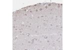 Immunohistochemical staining of human hippocampus shows moderate cytoplasmic positivity in neuronal cells.