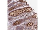 Immunohistochemical staining of human rectum shows strong granular cytoplasmic positivity in glandular cells.