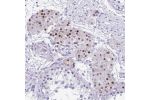 Immunohistochemical staining of human testis shows strong nuclear positivity in Leydig cells.