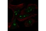 Immunofluorescent staining of human cell line RH-30 shows localization to nucleoli.
