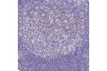 Immunohistochemical staining of human tonsil shows weak nuclear positivity in germinal center cells.