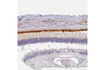 Immunohistochemical staining of human retina shows strong membranous positivty in retinal pigment epithelium.