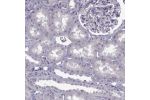 Immunohistochemical staining of human kidney shows strong nucleolar positivity in cells in tubules.