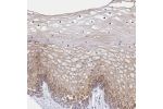 Immunohistochemical staining of human cervix, uterine shows moderate cytoplasmic positivity in squamous epithelial cells.