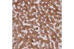 Immunohistochemical staining of human liver shows moderate cytoplasmic positivity in hepatocytes.