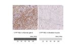 Immunohistochemistry analysis in human adrenal gland and skeletal muscle tissues using HPA057752 antibody. Corresponding CYP11B2 RNA-seq data are presented for the same tissues.