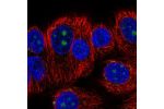 Immunofluorescent staining of human cell line MCF7 shows localization to nucleoli & vesicles.