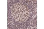 Immunohistochemical staining of human lymph node shows strong nuclear positivity in germinal center cells.