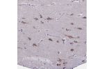 Immunohistochemical staining of human cerebral cortex shows strong cytoplasmic positivity in neuronal cells.