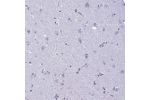 Immunohistochemical staining of human cerebral cortex shows weak positivity in neuronal cells.