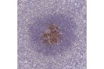 Immunohistochemical staining of human spleen shows strong granular cytoplasmic positivity in cells in white pulp.