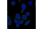 Immunofluorescent staining of human cell line REH shows localization to cytosol.