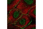 Immunofluorescent staining of human cell line A-431 shows localization to nucleoplasm & cell junctions.