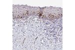 Immunohistochemical staining of human vagina shows strong nuclear positivity in squamous epithelial cells.