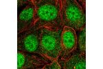 Immunofluorescent staining of human cell line MCF7 shows localization to nucleus.