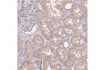 Immunohistochemical staining of human kidney shows moderate cytoplasmic and nuclear positivity in renal tubules.