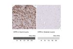 Immunohistochemistry analysis in human heart muscle and skeletal muscle tissues using HPA058269 antibody. Corresponding NPPA RNA-seq data are presented for the same tissues.