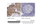 Immunohistochemistry analysis in human kidney and lymph node tissues using HPA058310 antibody. Corresponding BHMT RNA-seq data are presented for the same tissues.