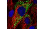 Immunofluorescent staining of human cell line BJ shows localization to endoplasmic reticulum.
