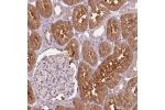 Immunohistochemical staining of human kidney shows moderate cytoplasmic positivity in cells in tubules.