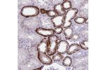 Immunohistochemical staining of human Kidney shows strong cytoplasmic and membranous positivity in cells in tubules.