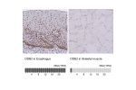 Immunohistochemistry analysis in human esophagus and skeletal muscle tissues using HPA058406 antibody. Corresponding DDB2 RNA-seq data are presented for the same tissues.