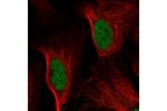 Immunofluorescent staining of human cell line U-2 OS shows localization to nucleoplasm.