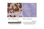 Immunohistochemistry analysis in human skeletal muscle and lymph node tissues using HPA058448 antibody. Corresponding TNNT1 RNA-seq data are presented for the same tissues.