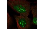 Immunofluorescent staining of human cell line U-2 OS shows localization to nucleus, nucleoli & cytosol.
