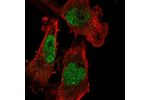 Immunofluorescent staining of human cell line U-251 MG shows localization to nucleoplasm.