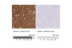 Immunohistochemistry analysis in human cerebral cortex and skeletal muscle tissues using HPA058511 antibody. Corresponding SIRPA RNA-seq data are presented for the same tissues.