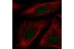 Immunofluorescent staining of human cell line A549 shows localization to nucleoplasm.