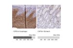Immunohistochemistry analysis in human esophagus and stomach tissues using Anti-CSTB antibody. Corresponding CSTB RNA-seq data are presented for the same tissues.